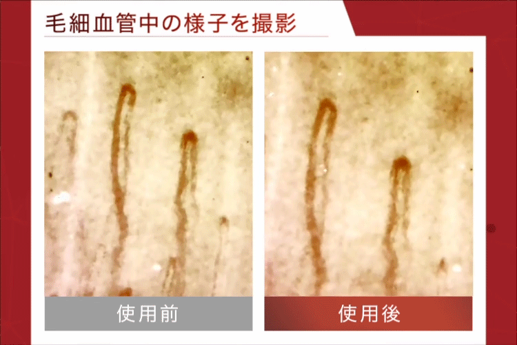 毛細血管中の様子を撮影