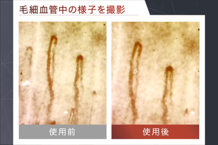 毛細血管中の様子を撮影