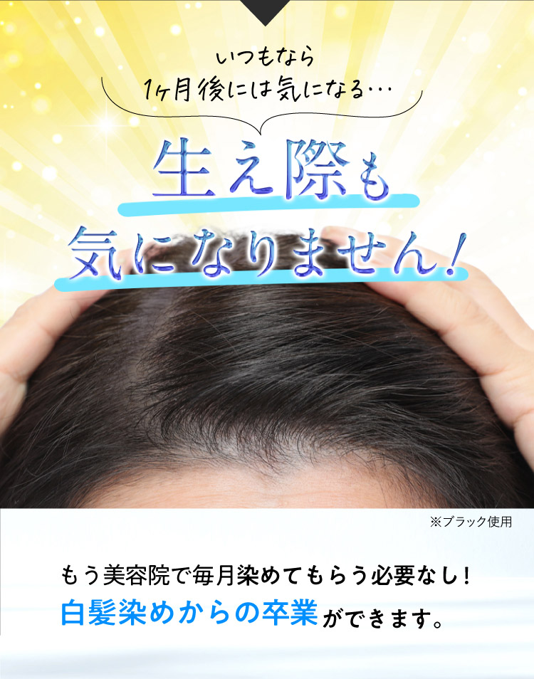 生え際も気になりません！