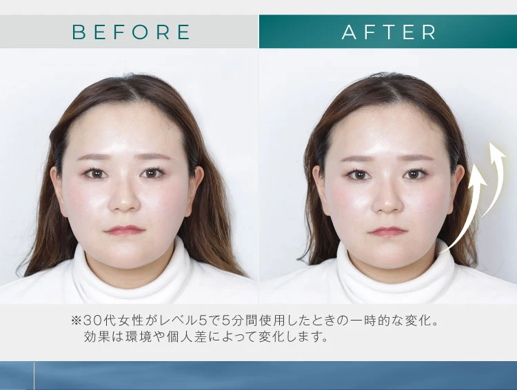 30代女性がレベル5で5分間使用した時の一時的な変化。効果は環境や個人差によって変化します。