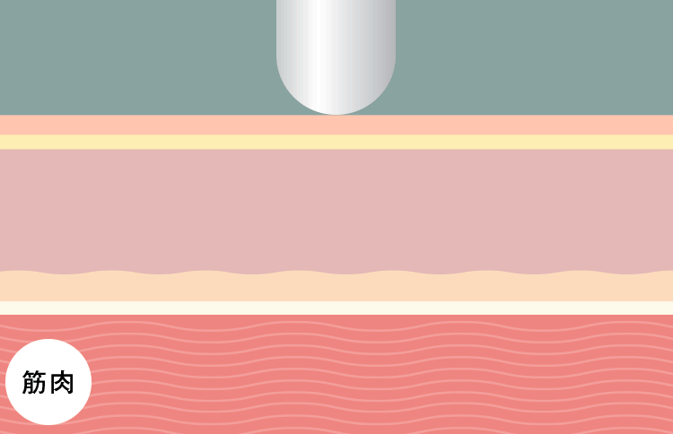 捉えてほぐすイメージ gif