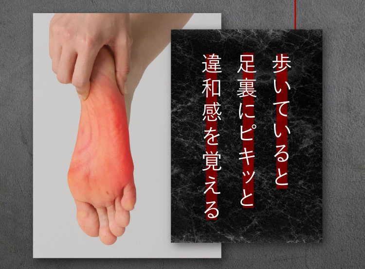 歩いていると足裏にピキッと違和感を覚える