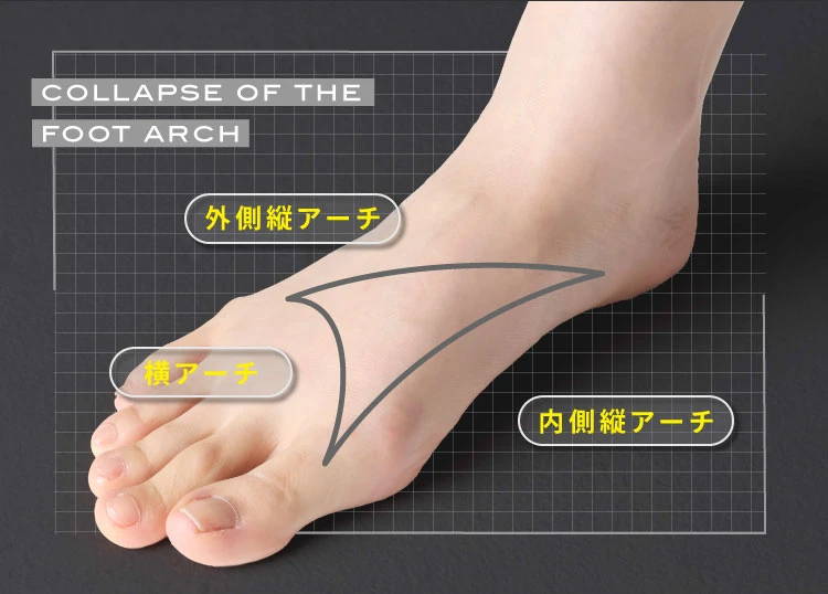 3つのアーチの図