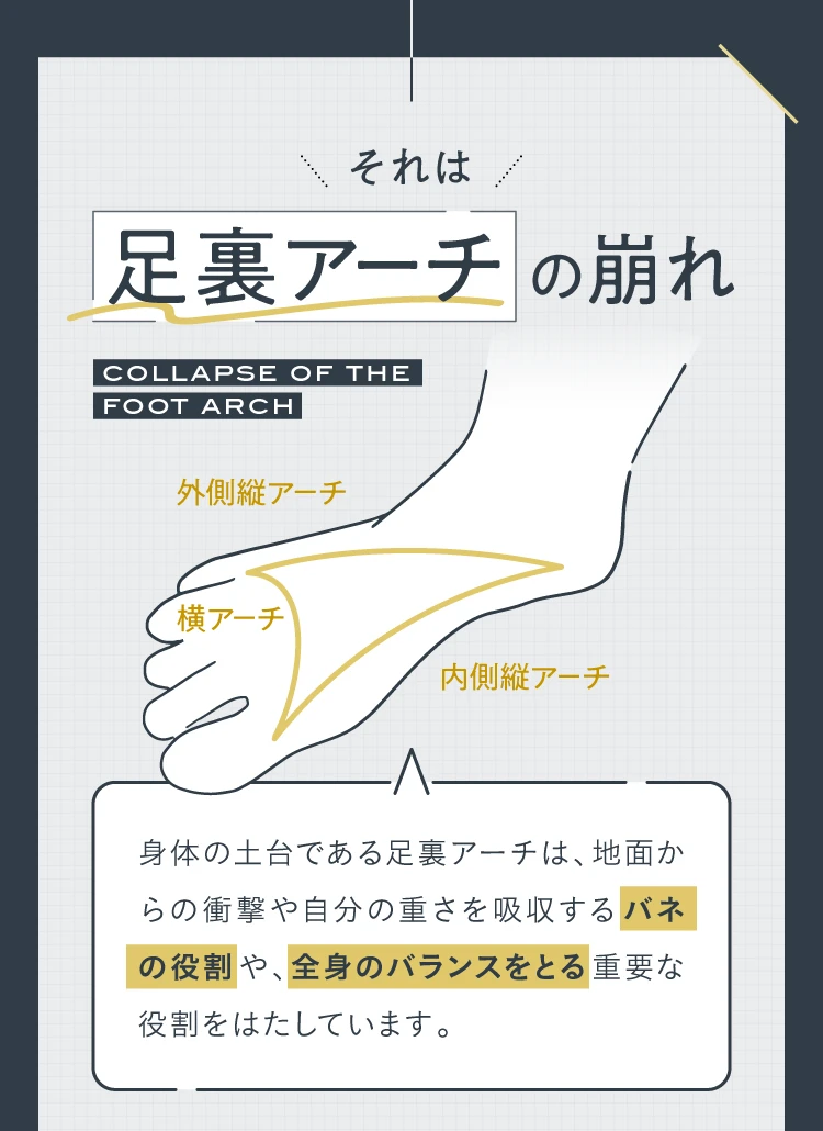 それは、足裏アーチの崩れ