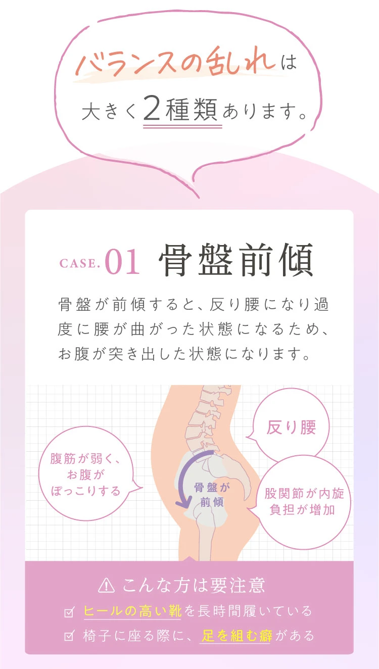 バランスの乱れは大きく2種類 １つめは骨盤前傾にあります