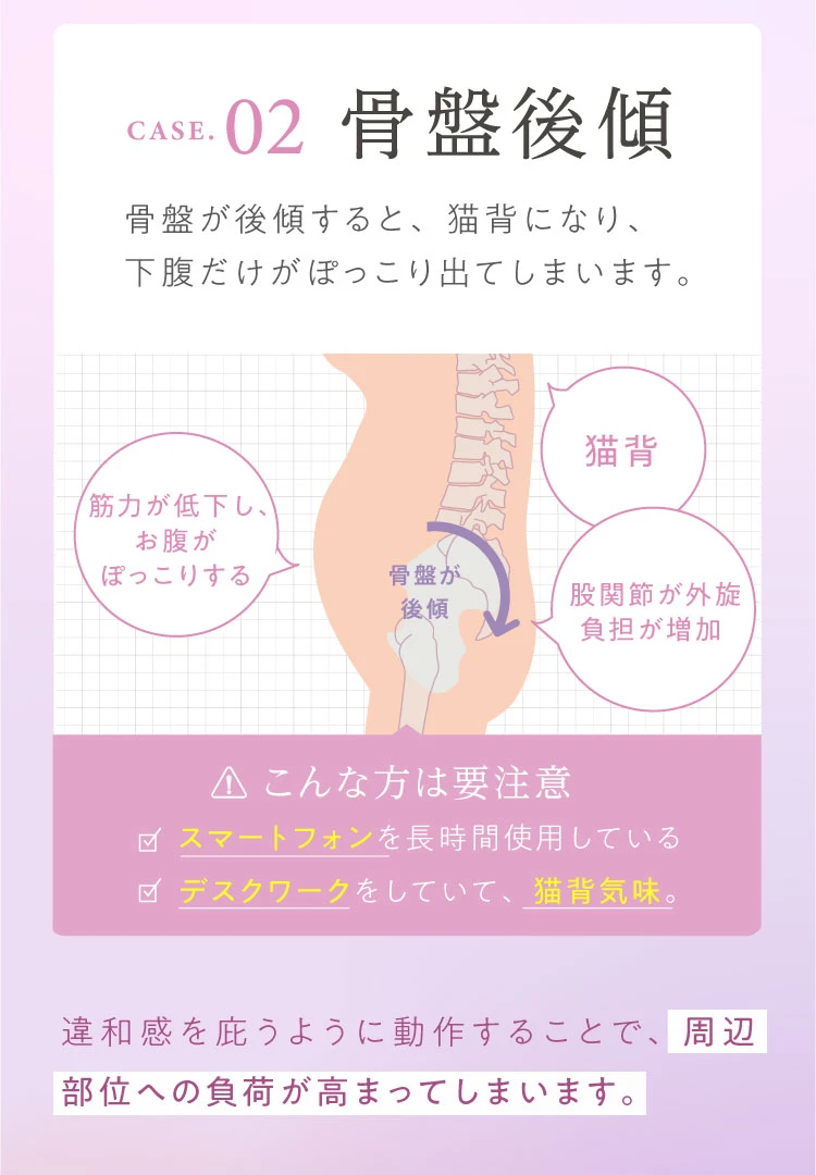 ２つめは骨盤後傾