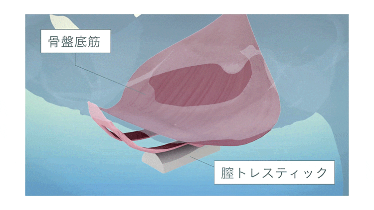 イメージCG