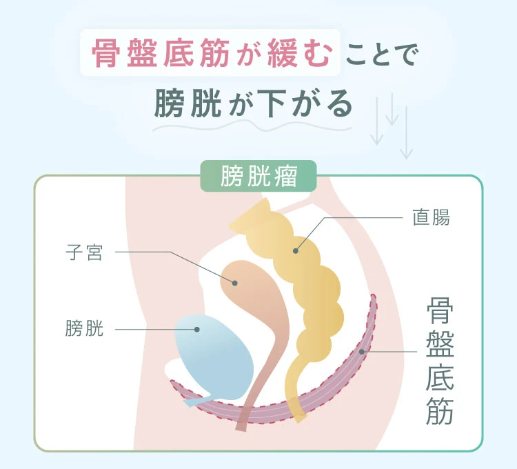 骨盤底筋が緩むことで膀胱が下がる