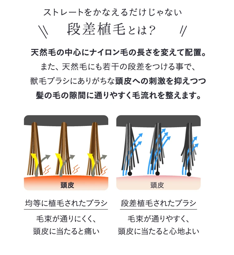 段差植毛とは