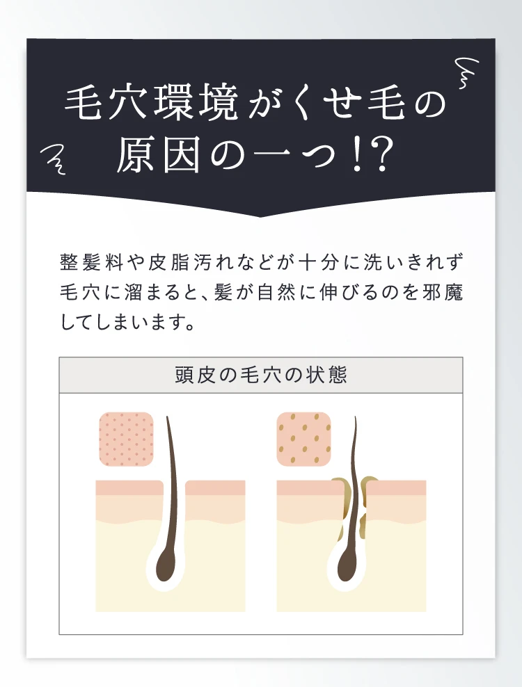 毛穴環境がくせ毛の原因の一つ!?整髪料や皮脂汚れなどが十分に洗いきれず毛穴に溜まると、髪が自然に伸びるのを邪魔してしまいます