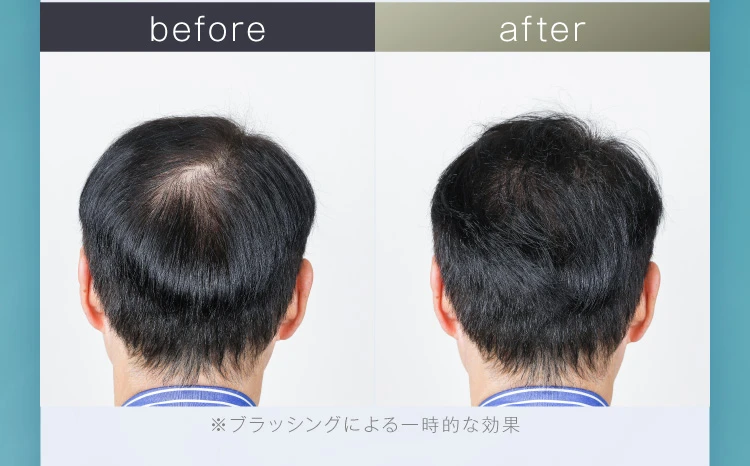 男性ビフォアフ