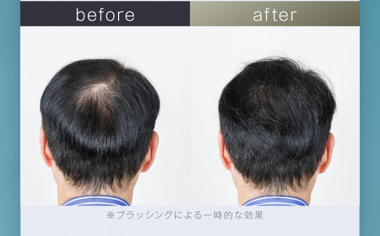 男性ビフォアフ